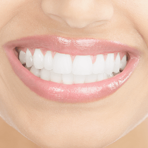 Возвращение естественной белизны зубов фото